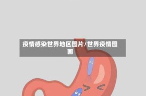 疫情感染世界地区图片/世界疫情图画