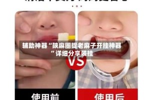 辅助神器“陕麻圈捉老麻子开挂神器”详细分享装挂