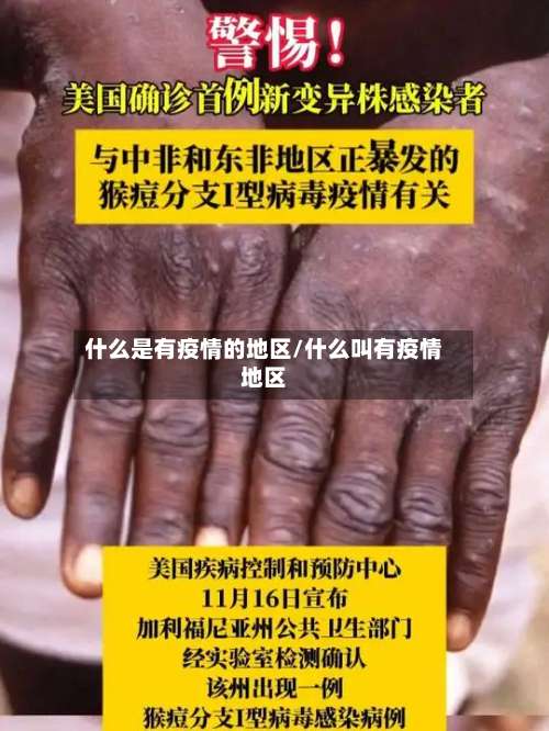 什么是有疫情的地区/什么叫有疫情地区-第2张图片