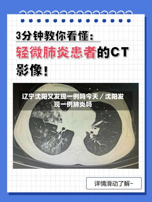 辽宁沈阳又发现一例吗今天／沈阳发现一例肺炎吗-第1张图片