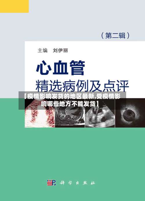 【疫情影响发货的地区最新,受疫情影响哪些地方不能发货】-第1张图片