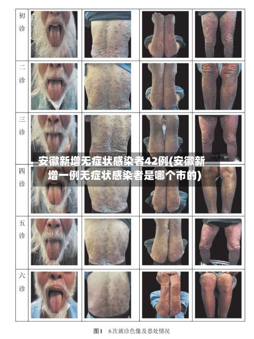 安徽新增无症状感染者42例(安徽新增一例无症状感染者是哪个市的)-第2张图片